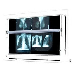 Mammoscope - Négatoscope pour mammographie à LED 300VA - Volet et barre...